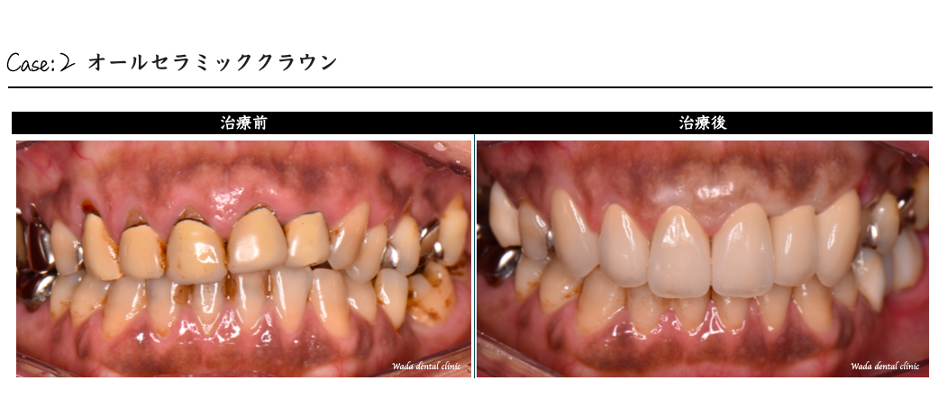 症例