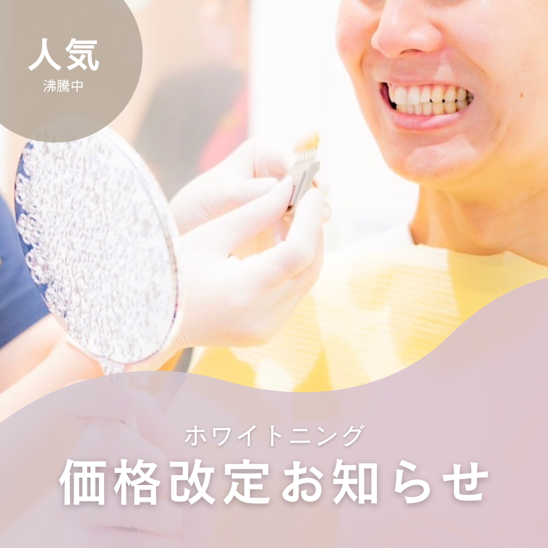 ホワイトニング価格改定