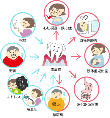 歯周病と全身疾患