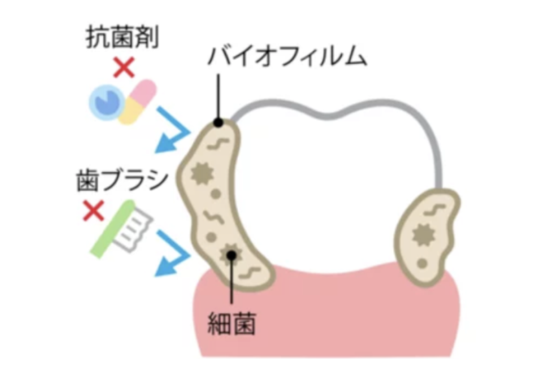バイオフィルムとは