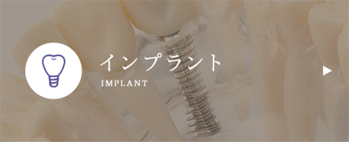 インプラント