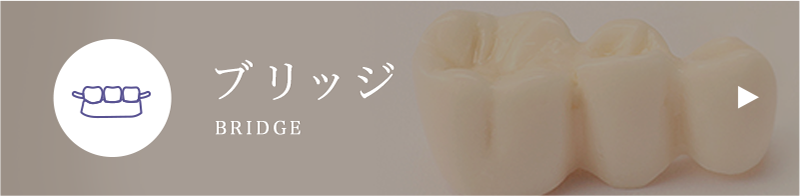 ブリッジ