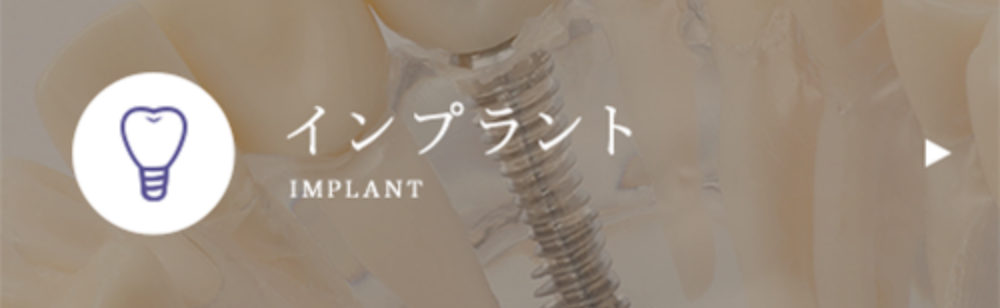 インプラント
