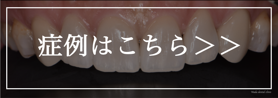 症例集